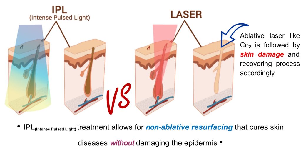laser_skin_treatment_image-4-1024x512
